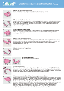 PDF: Brüchen von Zahnprothesen